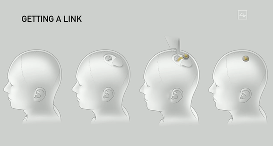 马斯克公布"脑机"Neural<em></em>ink